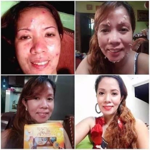 Beauty vault rejuvenating set - Picture 2 of 5